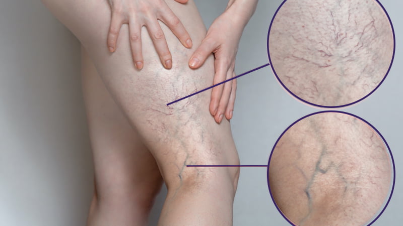 novomed ankle pain R4